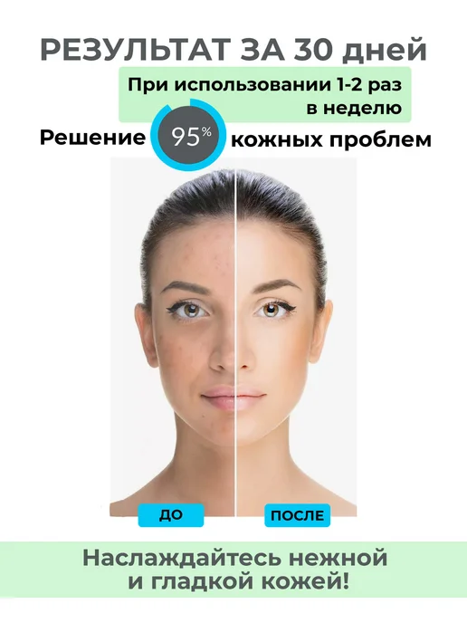 Фото товара 25457, пилинг скатка для тела с ниацинамидом и алоэ
